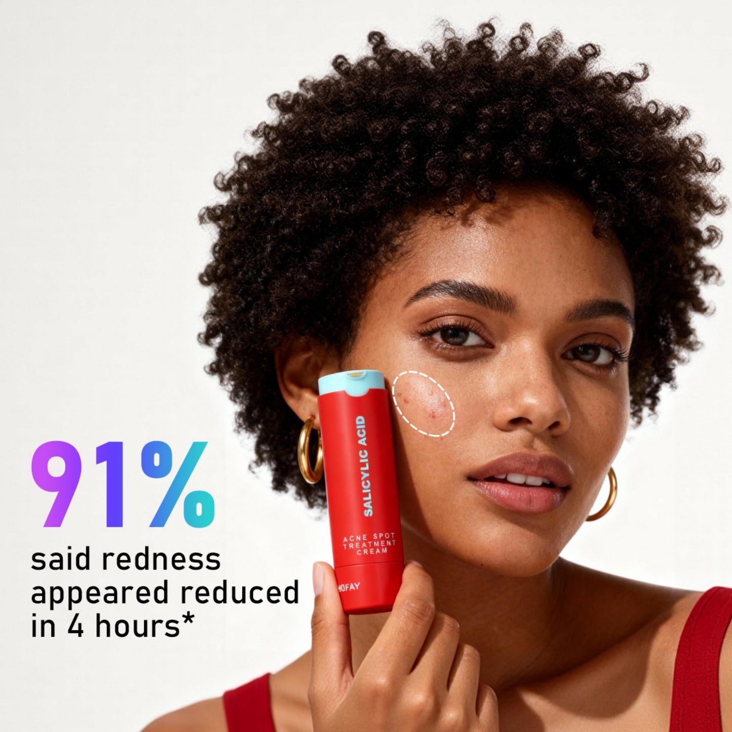 Loción para Eliminar el Acné C-S003