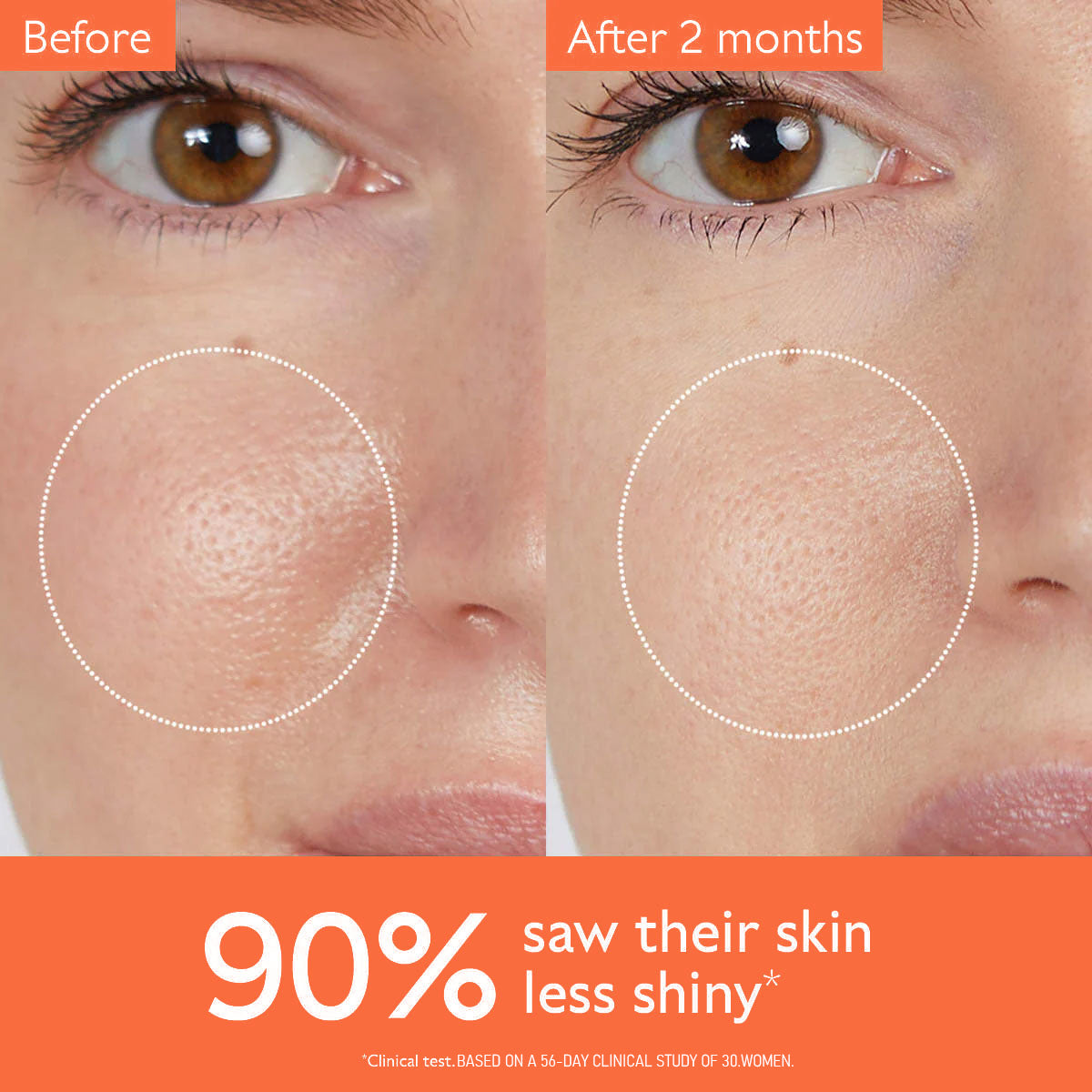 Tónico Astringente para Poros C-S004