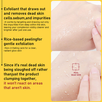 Solución Exfoliante Enzima de Papaya PHOFAY