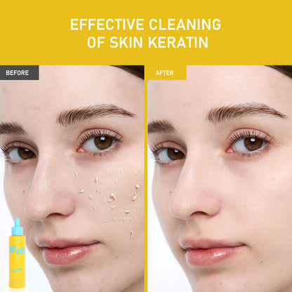 Solución Exfoliante Enzima de Papaya PHOFAY