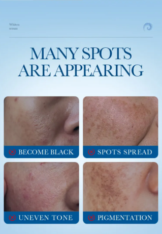 Sérum Contorno de Ojos Antiedad - Reduce Arrugas | InfinityShop